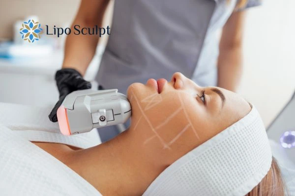 HIFU vs Botulinum Toxin: Understanding the Differences 1 HIFU vs Botox Scotland What is the best option for you?