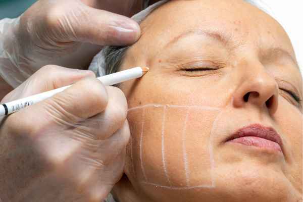 CryoPen: 5 Skin Concerns It May Be Used to Treat 4 What should you ask before having CryoPen treatment Scotland?