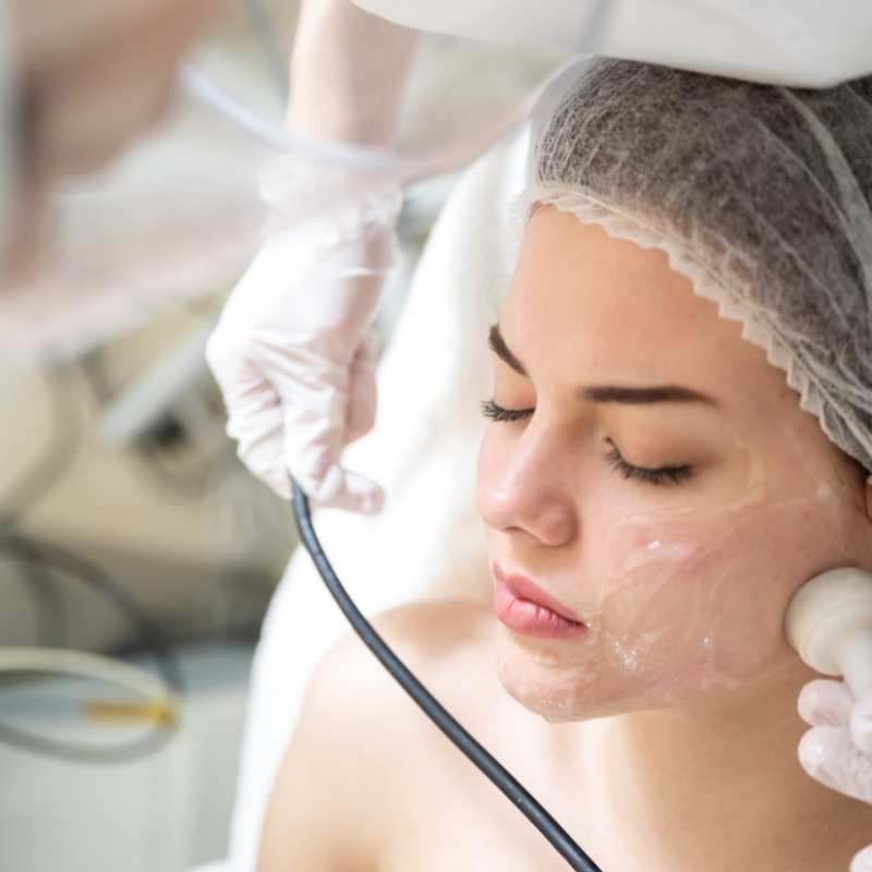 Why Do People Choose HIFU for a Non-Surgical Facelift? 5 What are the risks Scotland?